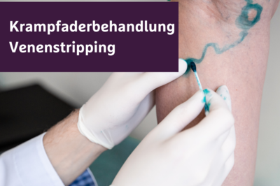 Krampfaderbehandlung mittels Venenstripping OP Havelklinik Berlin 